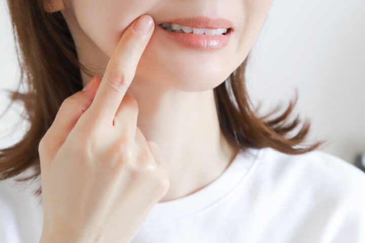 非抜歯矯正とは｜歯を抜かない選択の画像